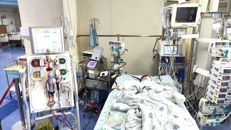 PICU里，上了ECMO+CRRT 的小依依。浙大兒院供圖